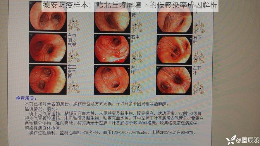 德安防疫样本：赣北丘陵屏障下的低感染率成因解析