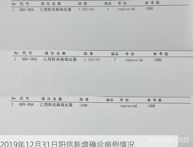 2019年12月31日阳信新增确诊病例情况