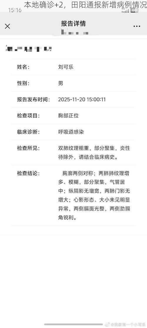 本地确诊+2，田阳通报新增病例情况