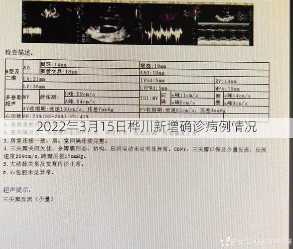 2022年3月15日桦川新增确诊病例情况