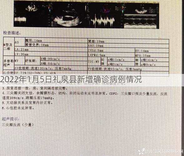 2022年1月5日礼泉县新增确诊病例情况