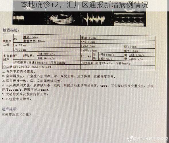 本地确诊+2，汇川区通报新增病例情况