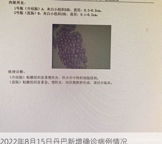 2022年8月15日丹巴新增确诊病例情况