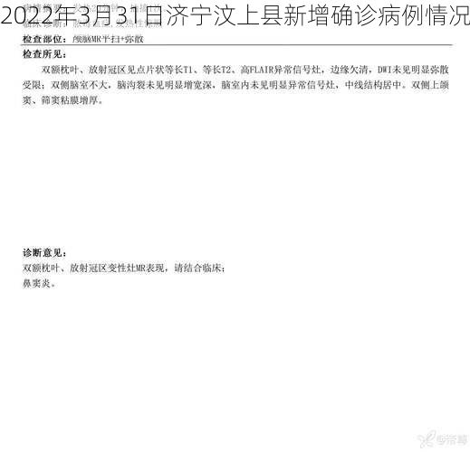 2022年3月31日济宁汶上县新增确诊病例情况