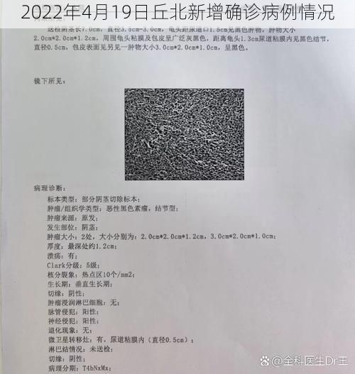 2022年4月19日丘北新增确诊病例情况