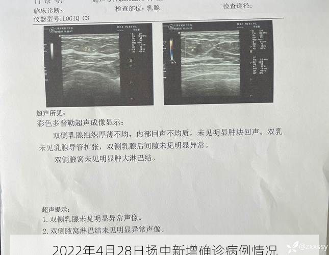 2022年4月28日扬中新增确诊病例情况