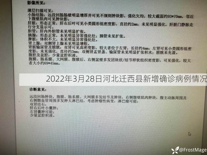 2022年3月28日河北迁西县新增确诊病例情况
