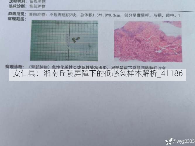 安仁县：湘南丘陵屏障下的低感染样本解析_41186