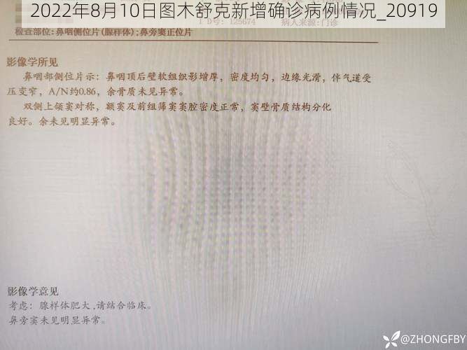 2022年8月10日图木舒克新增确诊病例情况_20919