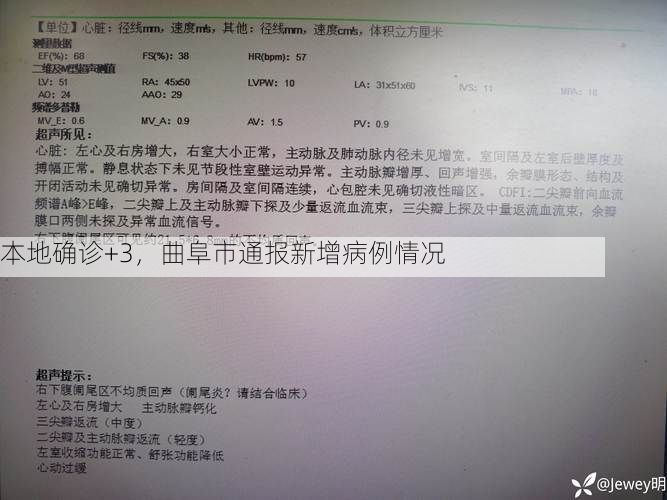 本地确诊+3，曲阜市通报新增病例情况