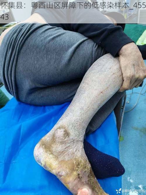 怀集县：粤西山区屏障下的低感染样本_45543
