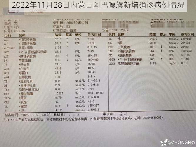 2022年11月28日内蒙古阿巴嘎旗新增确诊病例情况