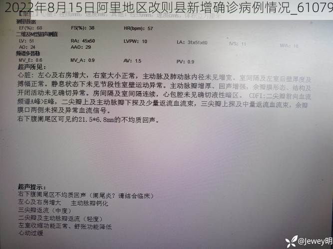 2022年8月15日阿里地区改则县新增确诊病例情况_61079