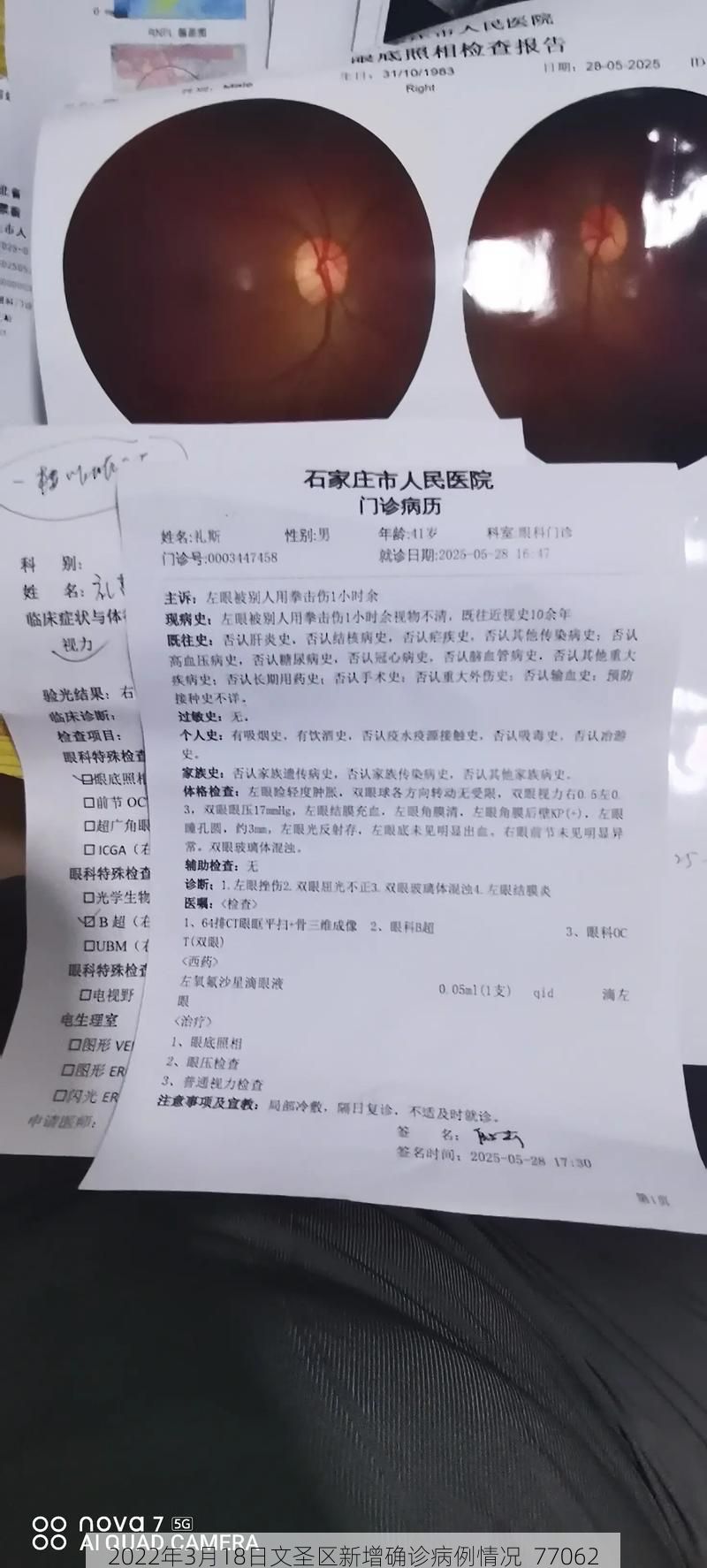 2022年3月18日文圣区新增确诊病例情况_77062