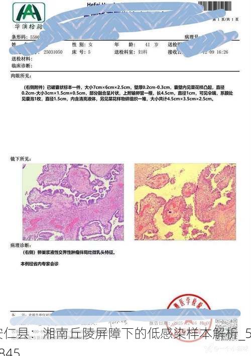 安仁县：湘南丘陵屏障下的低感染样本解析_59845