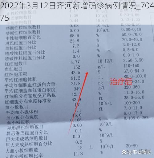 2022年3月12日齐河新增确诊病例情况_70475
