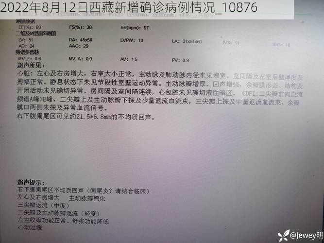 2022年8月12日西藏新增确诊病例情况_10876
