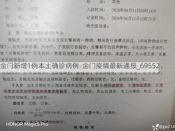 金门新增1例本土确诊病例 金门疫情最新通报_69552