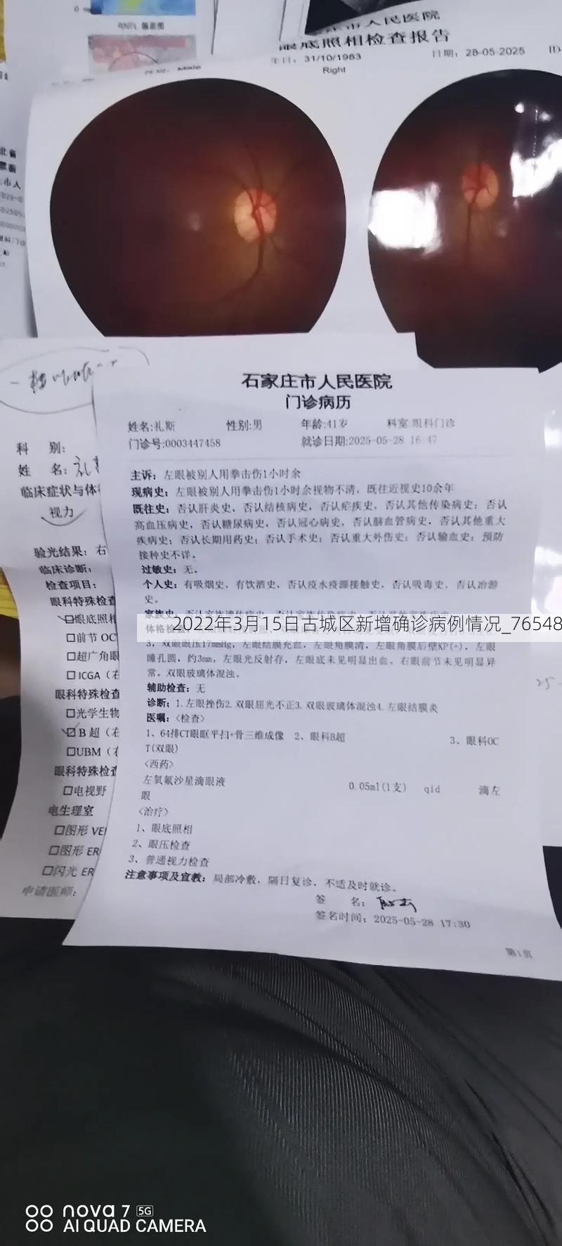 2022年3月15日古城区新增确诊病例情况_76548