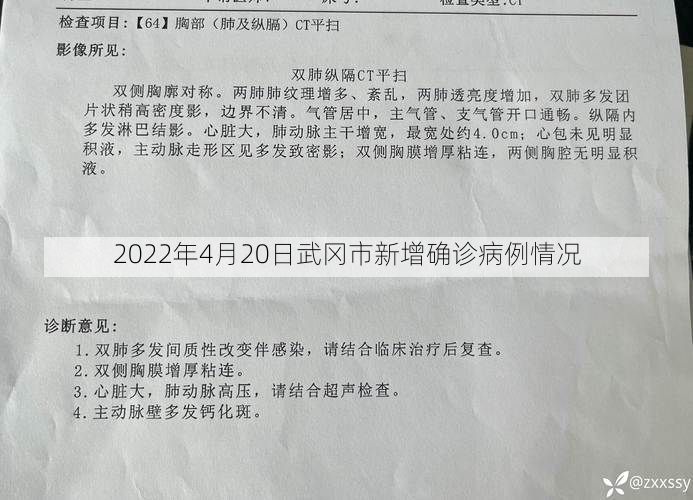 2022年4月20日武冈市新增确诊病例情况