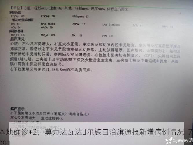 本地确诊+2，莫力达瓦达�尔族自治旗通报新增病例情况_71091