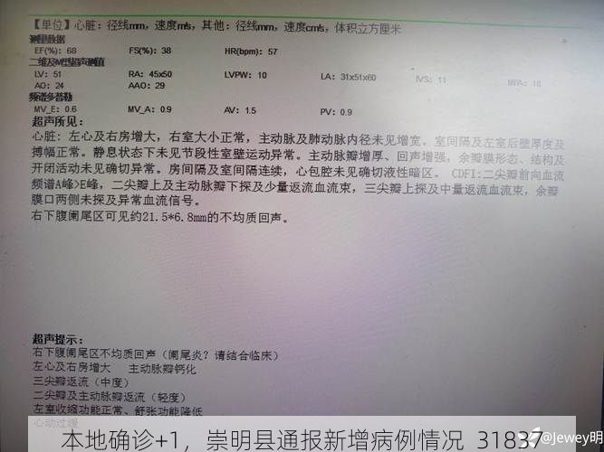 本地确诊+1，崇明县通报新增病例情况_31837