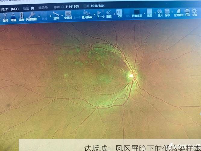 达坂城:风区屏障下的低感染样本