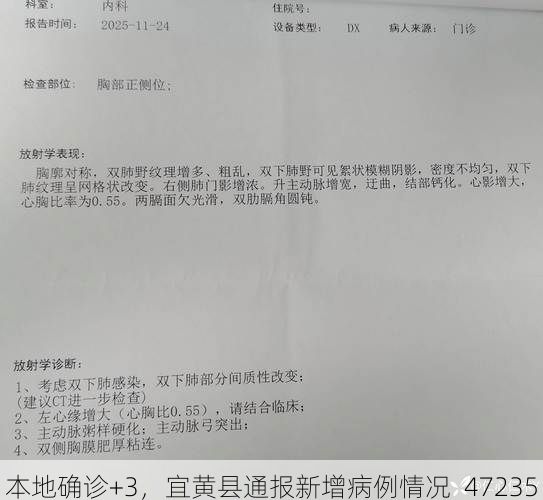 本地确诊+3,宜黄县通报新增病例情况_47235